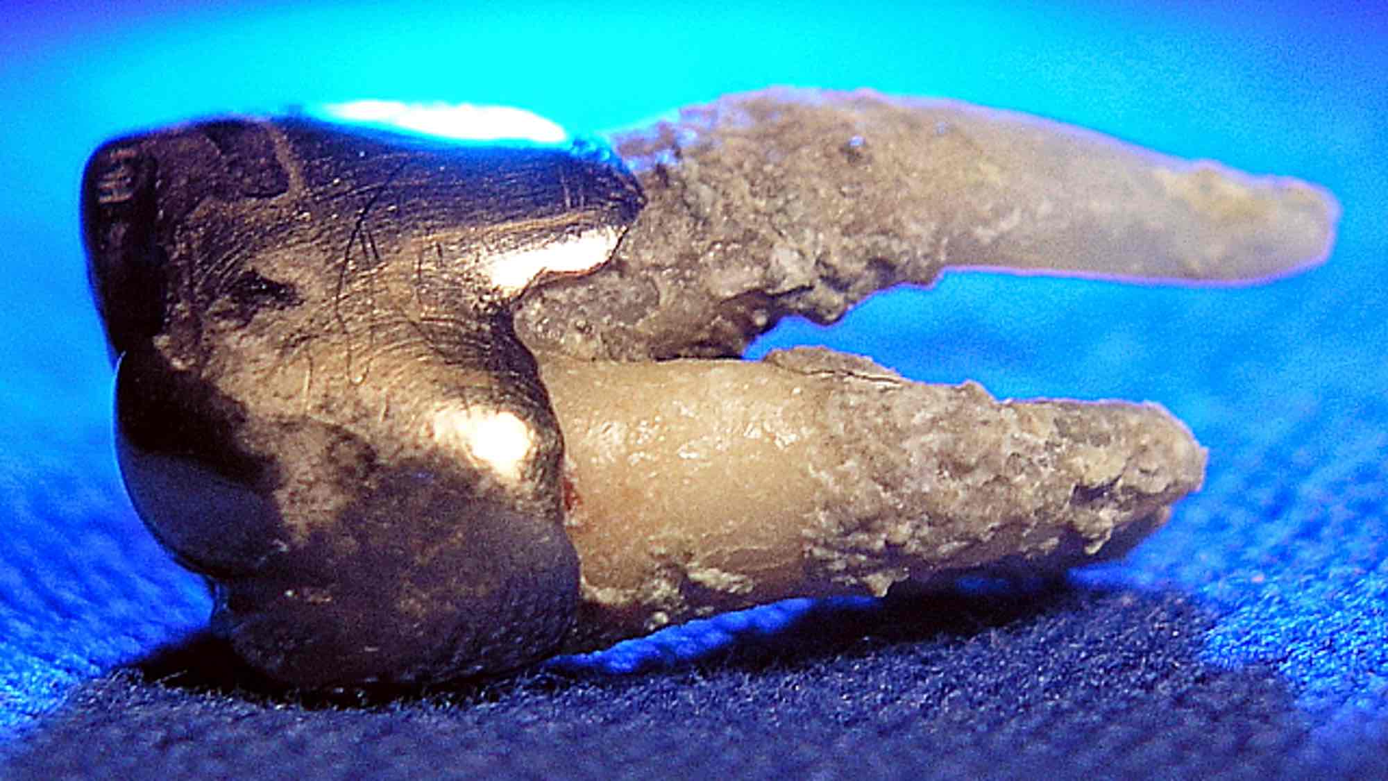 concretion
